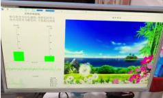 抽动症为什么春季易多发，大脑生物反馈仪