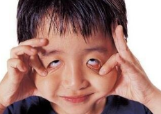 儿童抽动症